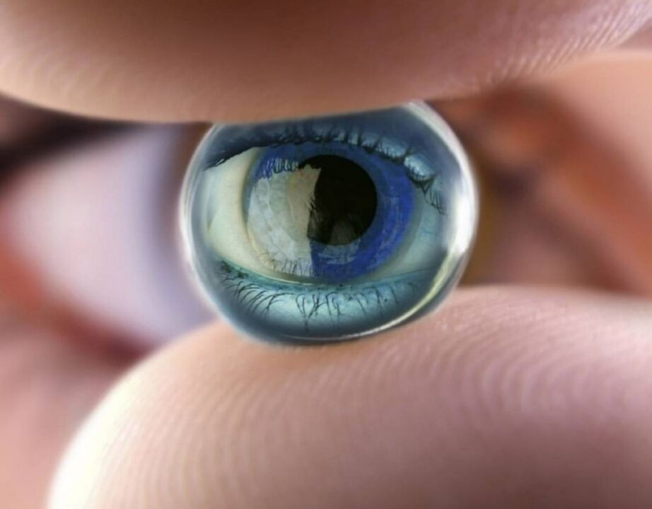 Nočne ortokeratološke leče bodo ustavile napredek pri okvari vida